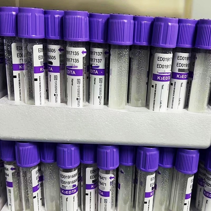 Vakum EDTA Kan Numune Tüpü 12/18 Karton Başına Raf 3.2mg/ml Katkı